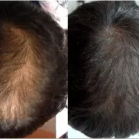 اینم خوب بود دیگه وقتشه با نانوکیت آشنا شی