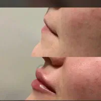 انجام خدمات زیبایی