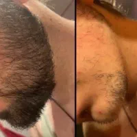 کمک میکنم از افسردگی در بیای