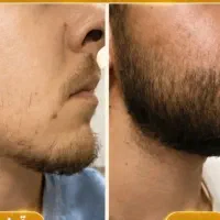 یه چهره جذاب برا خودت بساز