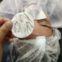 اصلاح تخصصی صورت (درماپلنینگ )