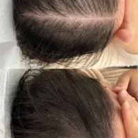 این اقدام اخریشه