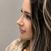 عمل زیبایی بینی 65 م از دم قسط و با چک صیادی