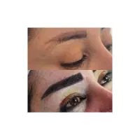 کاشت ابرو برای اولین بار در بوکان بدون جراحی