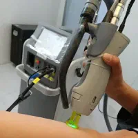 آف 50٪ لیزر کندلا،بدون ژل/شات نامحدود/بوتاکس ۱۲۰۰