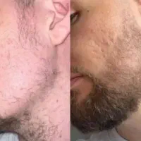 ریش پرپشت باما