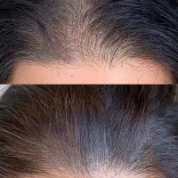 هنوز از موهای کم پشتت خسته نشودی
