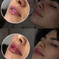 کلینیک زیبایی تخصصی بوتاکس،فیلر، ژل با 15سال سابقه