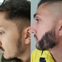 30 روزه ریشات رو پرپشت کن