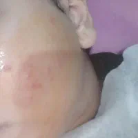 فشیال تخصصی پوست