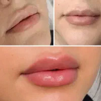 کلینیک پوست مو زیبایی و لیزردکتر ناهیدکرمی برازجان