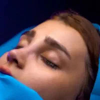 جراحی زیبایی بینی عمل بینی اهواز