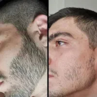 این اقدام اخریشه