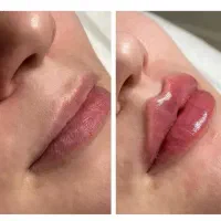 خدمات تخصصی زیبایی (فیلر، بوتاکس، لیزر و PRP) ‌ ‌