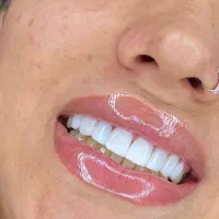 روکش|خدمات پیشه و مهارت|ایلام, |دیوار
