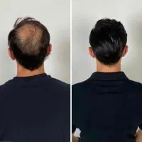 میدونستی که خوراکی راه حل توست
