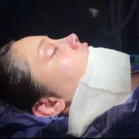 جراحی و عمل بینی/ با هزینه مناسب