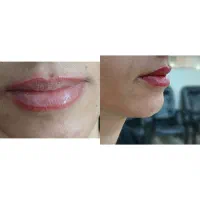 نیاز به مدل تتو صورت
