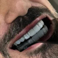 مرکز تخصصی ساخت پروتز و زیبایی دندان