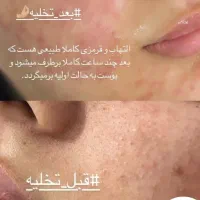 فیشیال تخصصی با دستگاه