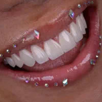 کامپوزیت،ایمپلنت،لمینیت اقساط ۱۲ ماهه