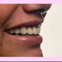 دندانپزشکی زیبایی و درمانی با تعرفه قبل