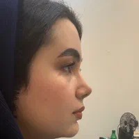 عمل بینی ویژه مراجعین سنقر/آف (۴۳تومن)در تهران