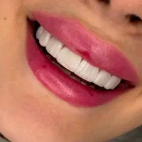 تخفیف خدمات زیبایی دندانپزشکی
