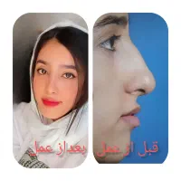 جراحی بینی بدون تامپون  ،پلک ،غبغب ،گوش
