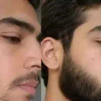 مردانگی واقعی ازچونه هات شروع میشه
