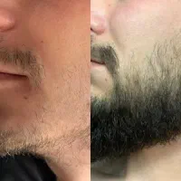 محصول آنتیک واسه ریشات