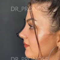 جرا حی،بینی|خدمات آرایشگری و زیبایی|شاهین‌شهر, عطار|دیوار