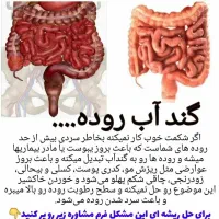 درمان یبوست باگیاه درمانی