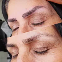 انجام میکروبلیدینگ ابرو