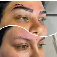 کاشت تخصصی ابرو - تخفیفی باور نکردنی در شیراز، خ قصرالدشت