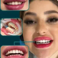 جشنواره بلیچینگ با تخفیف ۵۰ درصدی