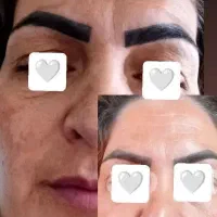 قوی ترین زد لک دنیا با ماسک صورت رایگان