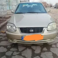 گیربکس هیوندا ورنا