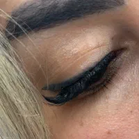 کاشت مژه هیدن