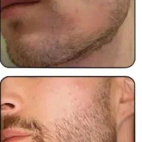 رویش دوباره از امروز