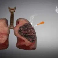 ترک اعتیاد تضمینی