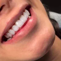 جشنواره ویژه کامپوزیت ونیر