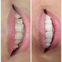 خدمات دندانپزشکی با تعرفه خیریه