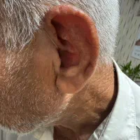 سمعک|پزشکی|تهران, شمس‌آباد|دیوار