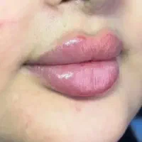 تخفیف 50درصد ژل لب نورامیس