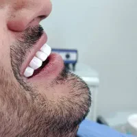 کامپوزیت دندان آتنا