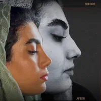 عمل بینی/تمدید تخفیف اخرماه/با پیزو/بدون تامپون/۳۵|خدمات آرایشگری و زیبایی|تهران, دزاشیب|دیوار