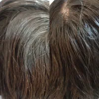 پاکسازی سر (شپش) میکاپ و شنیون، پاکسازی صورت