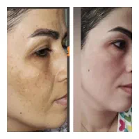 کرم های کاملا گیاهی( معجزه نیست)