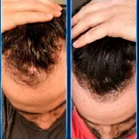 سلام به مو وریش سالم  وجذابیت